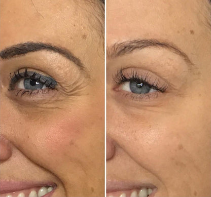 Nudara's Lumé AGE-R Booster